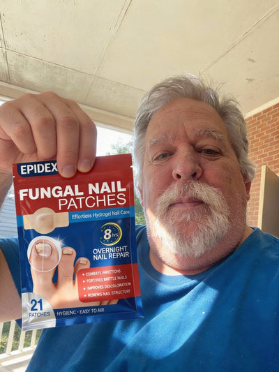 EPIDEX Fungal Nail Renewal Patches - Exclusive Offer
