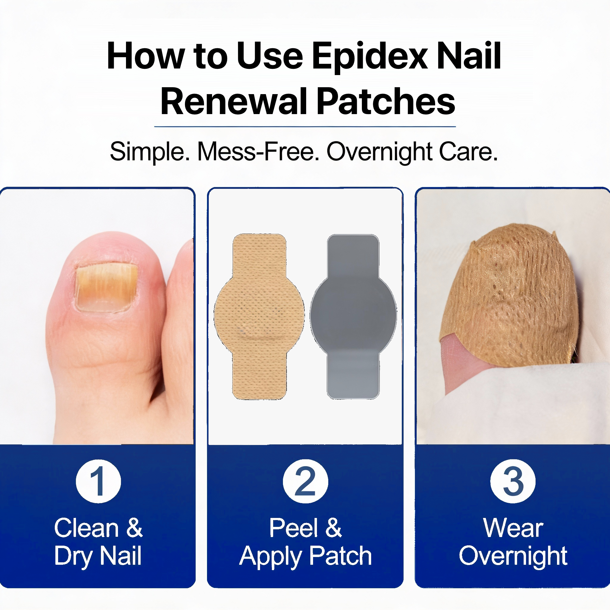 EPIDEX Fungal Nail Renewal Patches (6 Weeks)